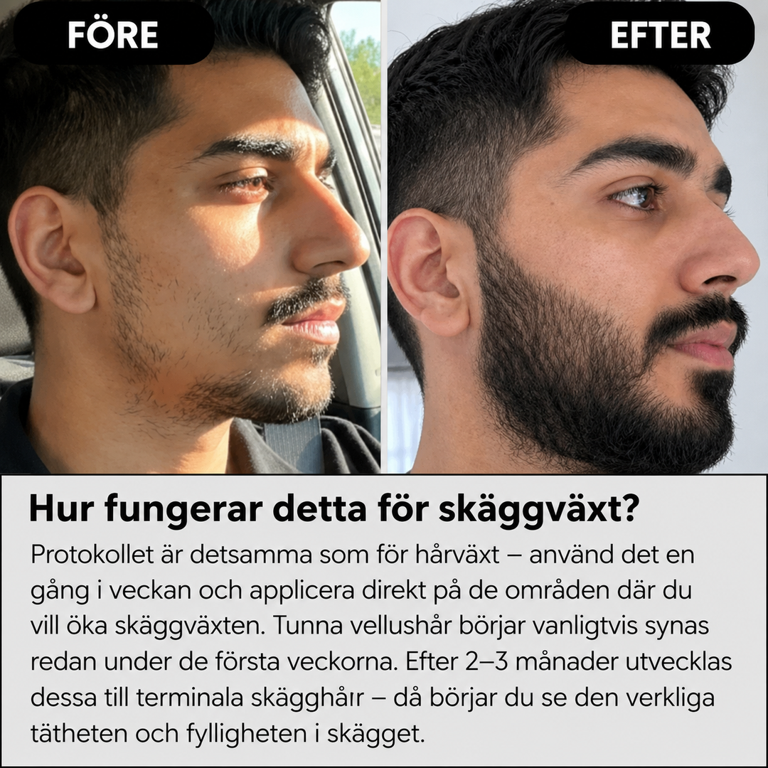 AlphaInfuse™ Hårtillväxtsystem